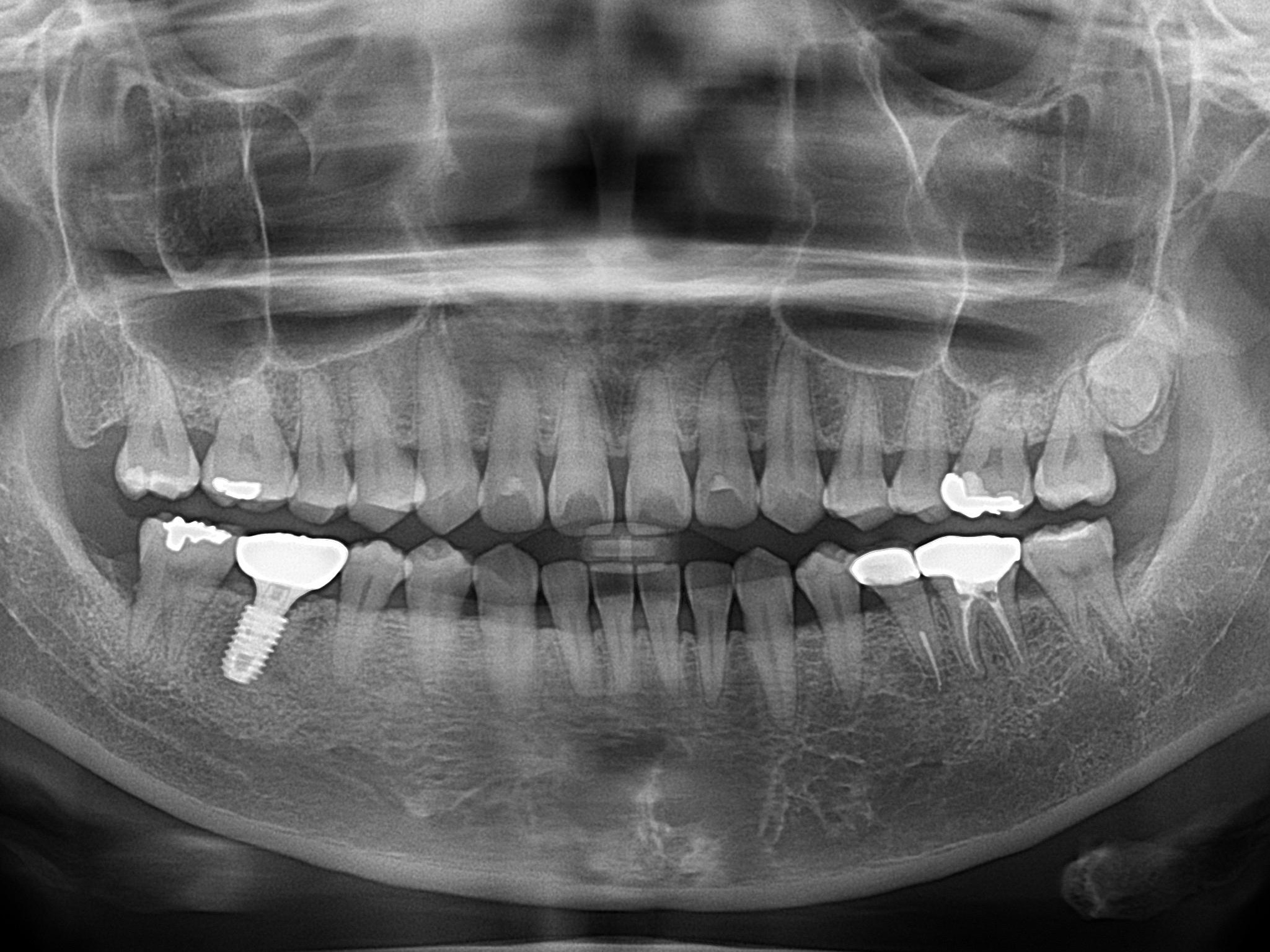 교정 전 파노라마·세팔로·3D CT 검사 안내