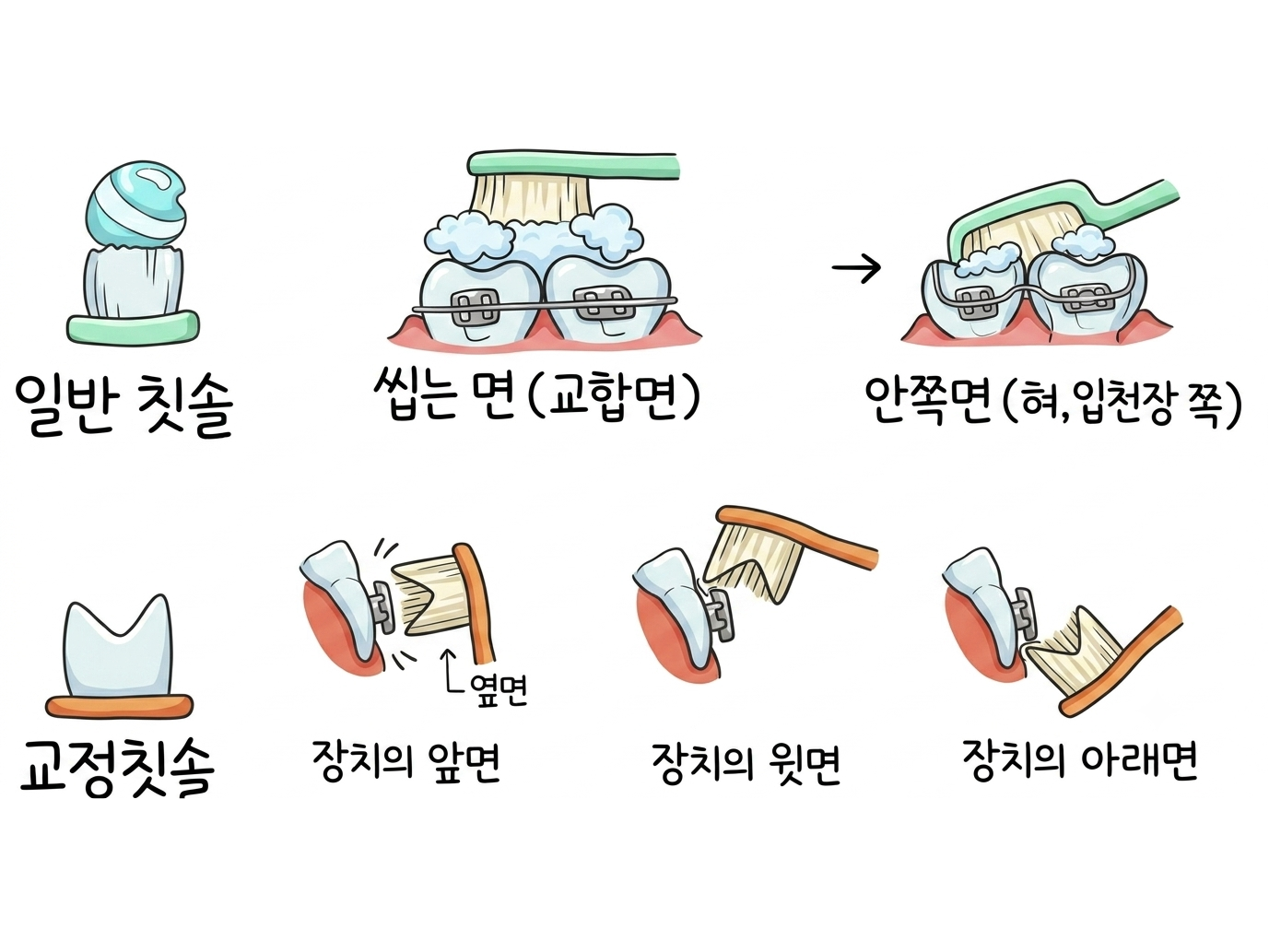 구의역 연세원드림치과 이호성 원장이 안내하는 교정 중 올바른 칫솔질 방법-AI이미지